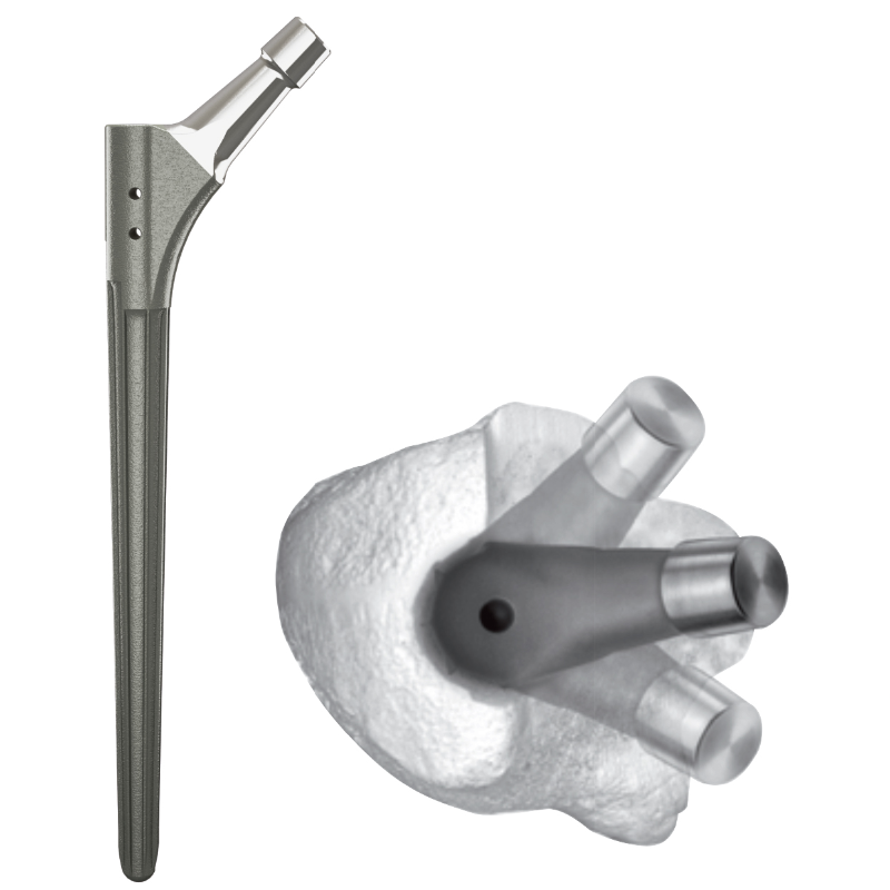 LDK Revısıon Femoral System